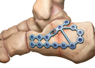 荊棘　0504 ランウォーク メンズ GORE-TEX防水 3E（1231A147-002）RUNWALK